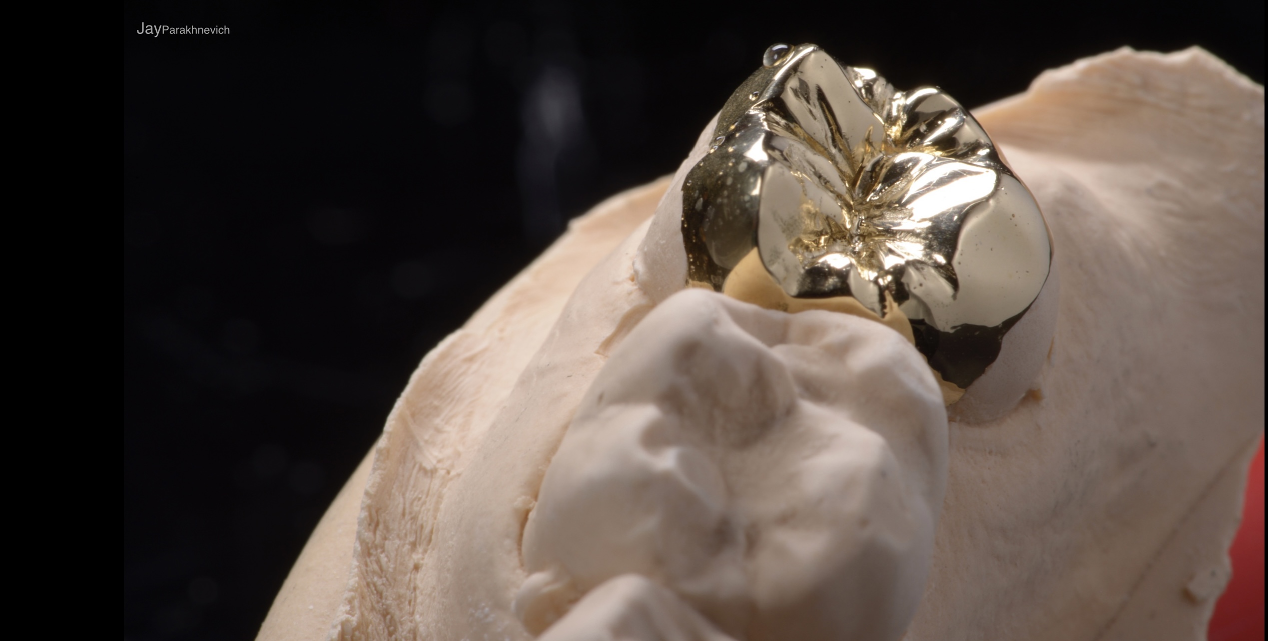 Gold Restoration